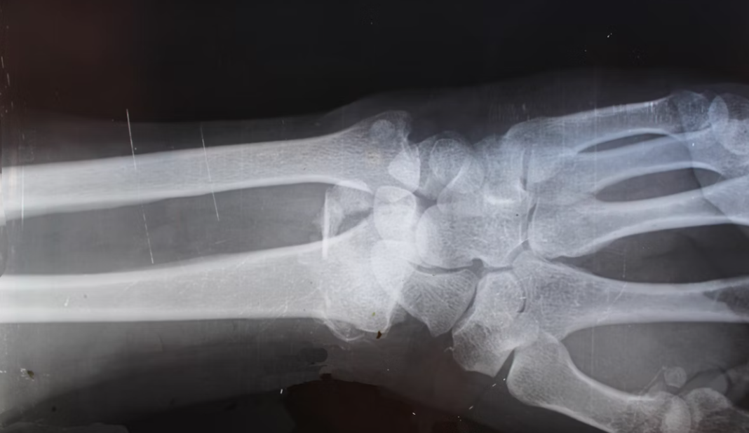 Orthopedic Healthcare